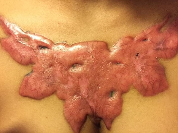 13. "Теперь у меня рубец, который навряд ли получится когда-нибудь убрать"