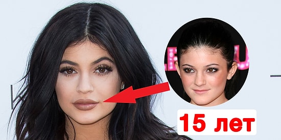 10 знаменитостей, которые легли под нож хирурга в очень молодом возрасте