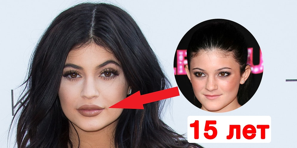 10 знаменитостей, которые легли под нож хирурга в очень молодом возрасте