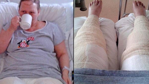 44 yaşındaki Dana Sedgewick, bikini bölgesini tıraş etti. Vücudu hiç beklenmedik bir tepki verdi ve 9 gün komada kaldı. 😱