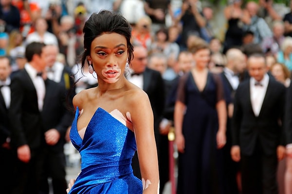 2. Ох уж этот хищный взгляд, коралловая помада и пигментация вокруг губ!