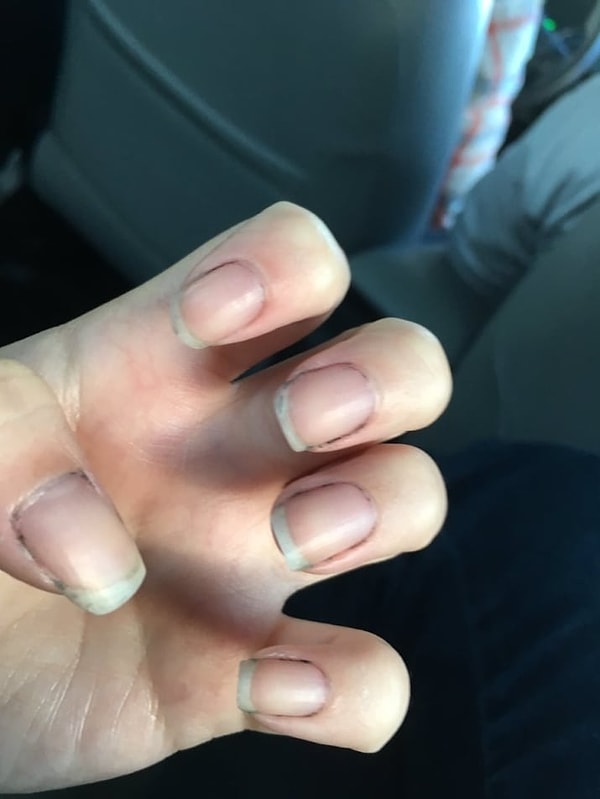 8. А вот что происходит после того, как вы стёрли с ногтей чёрный лак: