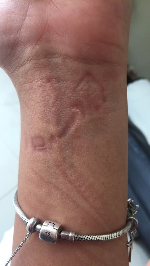 12. Дремать на своей руке тоже не всегда бывает безопасно: