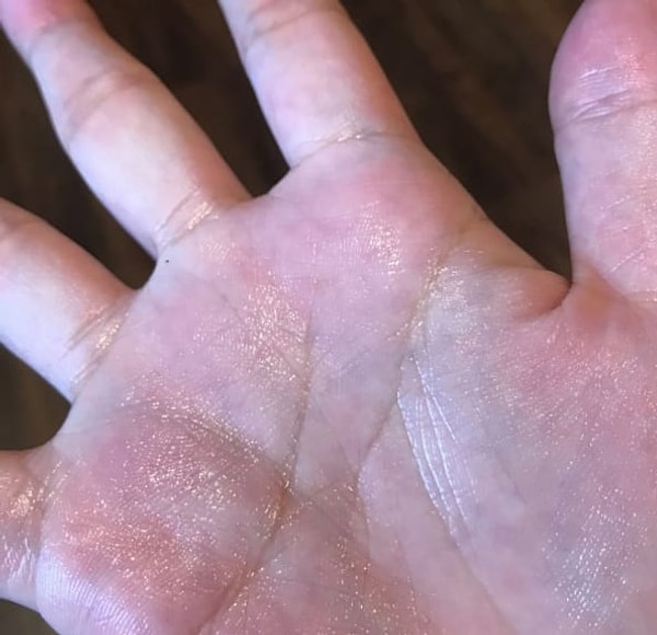 1. Вы не можете держать кого-то за руку дольше 5 секунд, иначе страдать от вашей потливости будете не только вы сами...