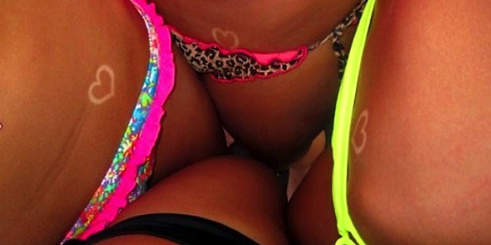 Artık Sadece Güzel Bronzlaşmak Yetmiyor! İşte Karşınızda Güneş Yanığı Sanatı