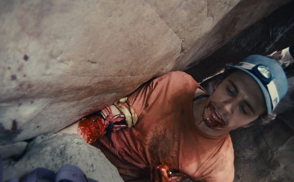 9. Протезы отрезанных частей тела