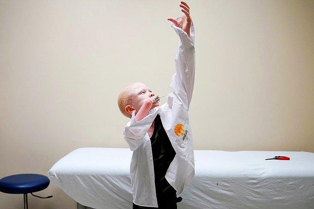 4. 7 yaşındaki Tanzanyalı Baraka Lusambo, albino olduğu için cadı sanılarak kolu kesilmişti.