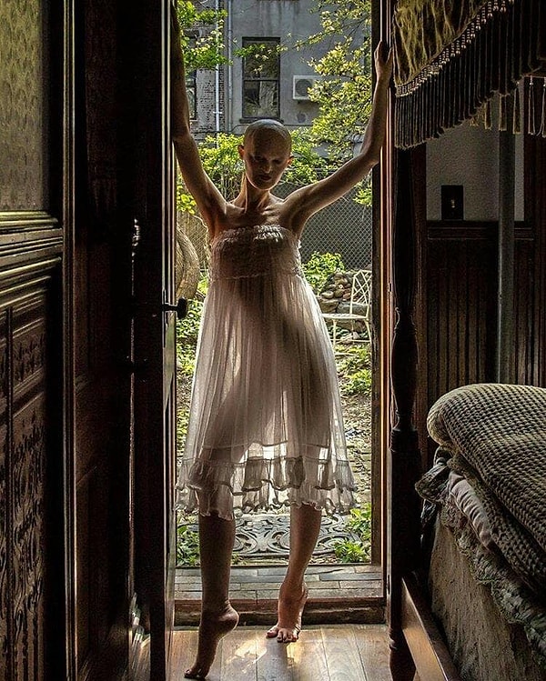 4. Раньше Мелани носила парики и протезы и снимала всю эту атрибутику по возвращению домой. Она признаётся, что протезы были жутко неудобными, и терпения хватило всего на 8 месяцев.