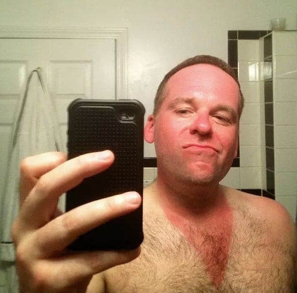 10. Даже самые маленькие незащищённые участки тела могут легко пострадать...