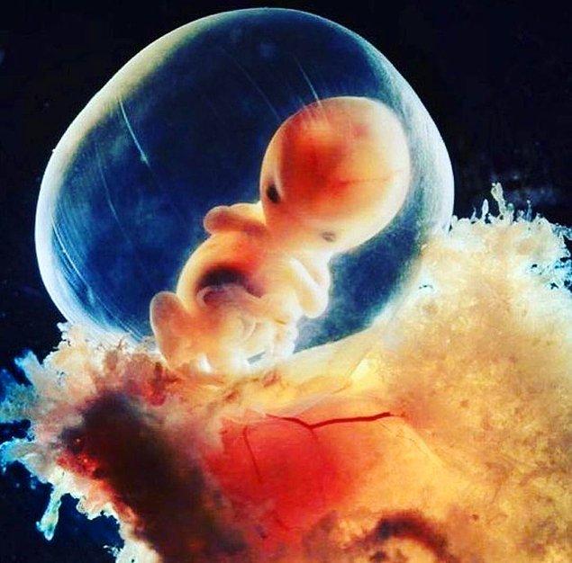 16. Amniyotik boşluk ile çevrili, uterus'a bağlı plasentaya tutunmuş bir fetüs.