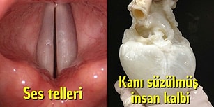 Şaşırmamak Ne Mümkün! Vücudumuzla İlgili Belki İlk Kez Göreceğiniz 20 Ekstrem Görüntü