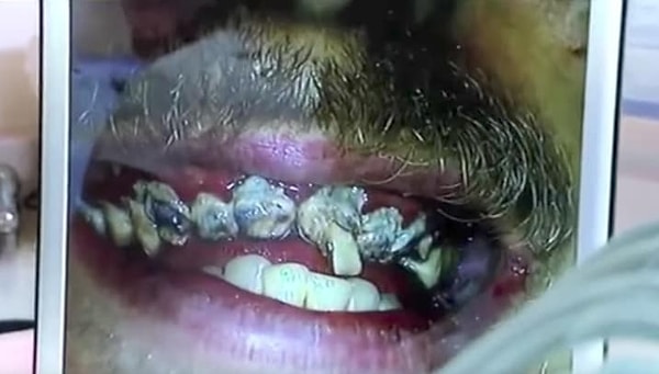 3. ЗА ВСЮ СВОЮ ЖИЗНЬ ДЖЕЙ НИ РАЗУ НЕ ЧИСТИЛ ЗУБЫ! 😯