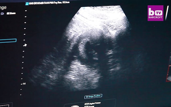 2. Однако в один день все изменилось…