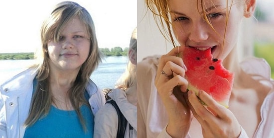 Российская девушка, страдавшая от бодишейминга, похудела и стала сногсшибательной моделью