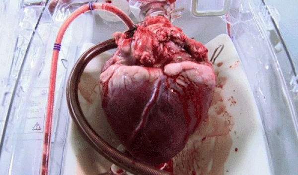 8. İnsan kalbinin oluşturduğu basınç, kanı 10 metre yüksekliğe fışkırtabilir. Kanın vücuda dağıtılabilmesi için böyle yüksek bir basınca ve bunu kaldırabilecek güçte bir kalbe ihtiyacımız var.