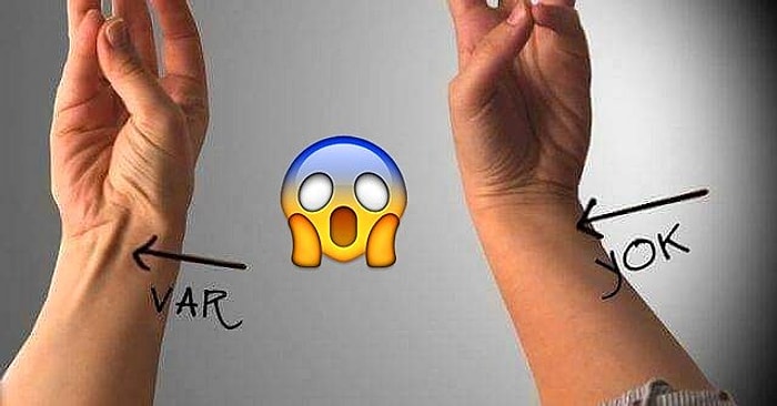 200.000 Yıllık İnsan Evriminin En Acayip Detaylarından Biri: Palmaris Longus