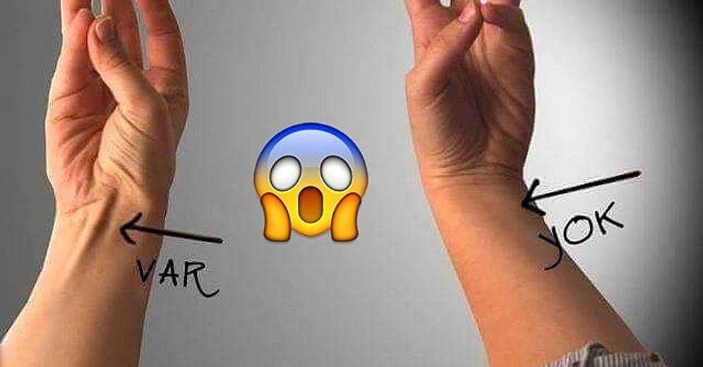 200.000 Yıllık İnsan Evriminin En Acayip Detaylarından Biri: Palmaris Longus