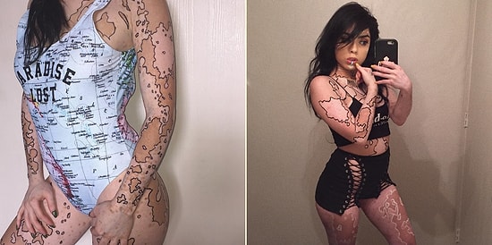 Vitiligo'nun Meydana Getirdiği Değişikliklerden Yararlanıp Vücudunu Tuvale Dönüştüren Kadın