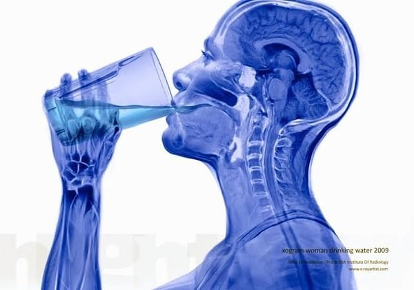 5. Интересное зрелище...