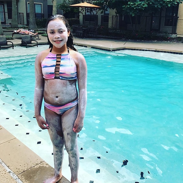 12. Родители этой девочки очень боялись, что она сгорит на солнце...