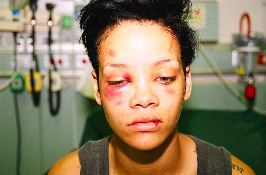 Hem Suçlu, Hem Güçlü! Chris Brown'ın Rihanna ile İlgili Tüy Diken ...'ın Rihanna ile İlgili Tüy Diken ...