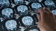 Ailesinde veya Yakın Çevresinde Alzheimer Hastası Olanların Çok İyi Bildiği 15 Şey
