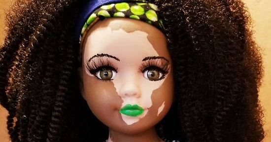 Художница создает куклы с витилиго, чтобы больные им детки чувствовали себя увереннее