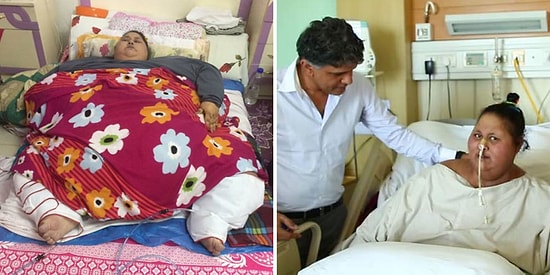 Самая толстая в мире женщина, похудевшая на 323 кг, скончалась