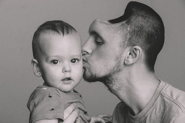 7. В этих трогательных фото заключена вся красота и боль этой семьи.