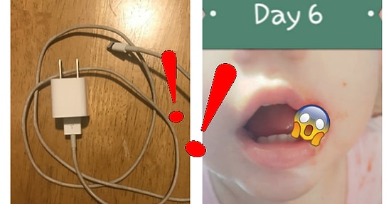 Aman Dikkat! Bebeğinin Ağzı Bir Şarj Cihazının Ucundan Yanınca Herkesi Uyaran Anne