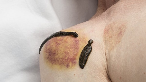 5. Люди верили, что тело управляется четырьмя силами