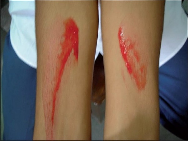 4. Наблюдается такое состояние обычно при сильном стрессе и напряжении.