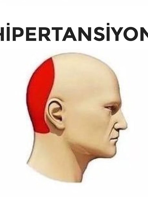 Baş Ağrısı Çeşitlerinin Etkilediği Bölgelere Yaptıkları Capslerle Ağrı Falan Bırakmayan 15 Goygoycu