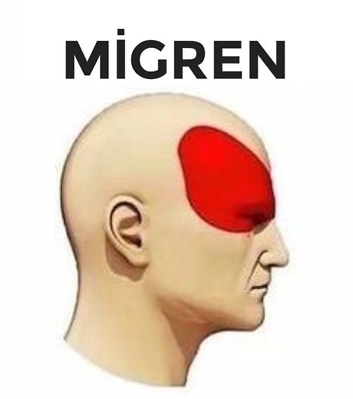 Baş Ağrısı Çeşitlerinin Etkilediği Bölgelere Yaptıkları Capslerle Ağrı Falan Bırakmayan 15 Goygoycu