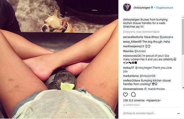 2. Модель Крисси Тейген показала, как беременность повлияла на ее тело