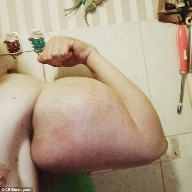 Geçtiğimiz yaz askerden dönünce synthol kullanmaya başlayan Kirill Tereshin, kol kaslarını sadece 10 gün içinde bu hale getirdi.