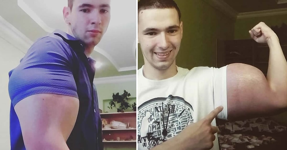 Убийственные бицепсы русского "качка": синтол головного мозга