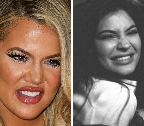 Даже самый естественный ботокс блокирует мимику.