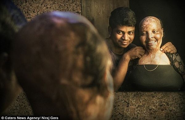 После того как Рани выписали из больницы, ребята начали жить вместе, поселившись в Дели. Все это время они готовились к свадьбе, которая состоится в самое ближайшее время.