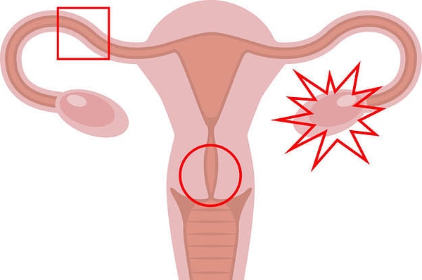 7. Какой фигурой обозначена шейка матки на рисунке?
