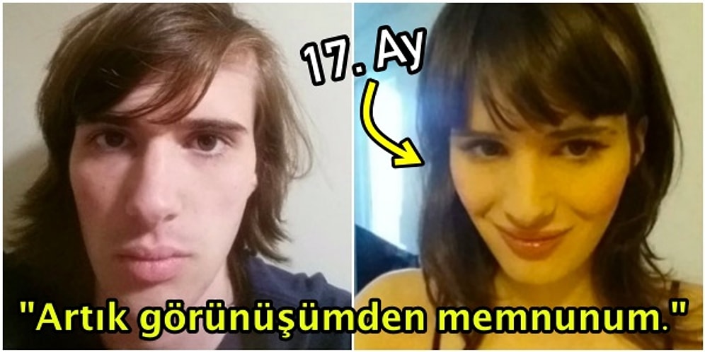 Cinsiyet Değiştirmek İçin Gördüğü 17 Aylık Hormon Tedavisi Boyunca, Değişimini Fotoğraflayan Transeksüel Kadın
