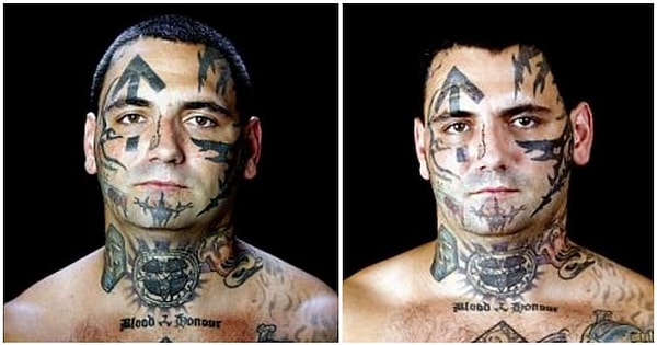 7. Там Брайону собрали необходимую сумму на операции по удалению тату.