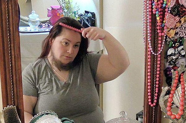 7. Гирсутизм, как вы уже наверняка поняли сами, не стоит игнорировать