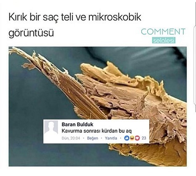 7. Mikroskobik kürdan