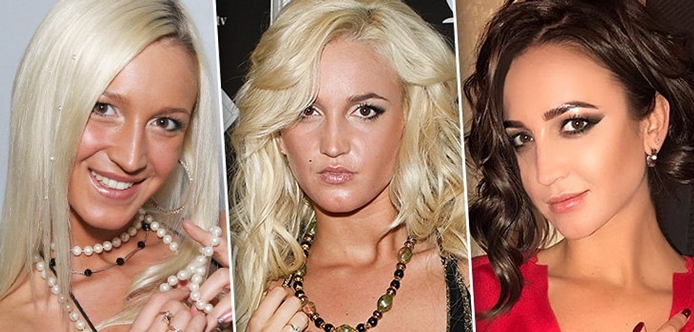 Свет мой, зеркальце, скажи, да всю правду доложи: 10 российских звезд до и после пластики