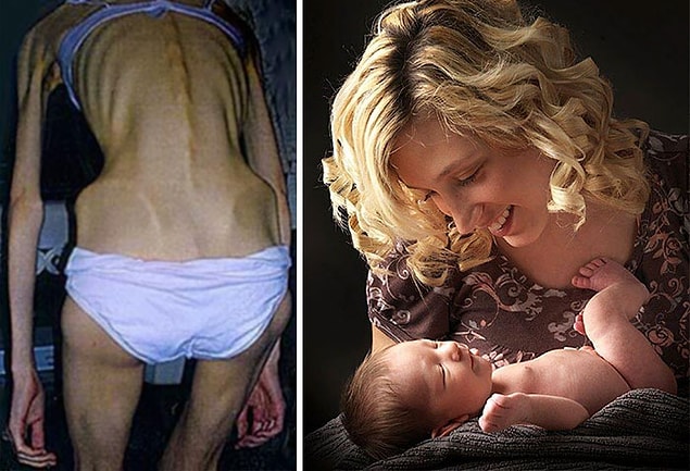18. Bir zamanlar yalnızca 10 gününün kaldığı söylenen Hayley Wilde ve oğlu 👇