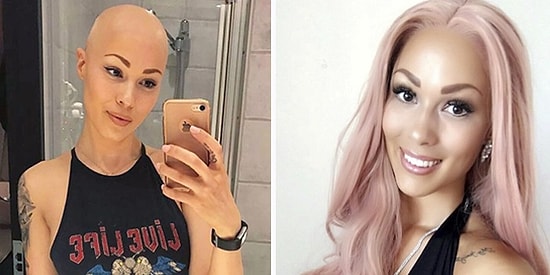 Никогда не сдаваться! Девушка с облысевшей из-за болезни головой превратила свой недостаток в изюминку!