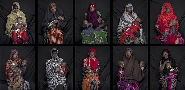 13. Somali'de hasta çocuklar. 📷 Arif Hüdaverdi Yaman