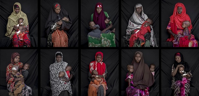 13. Somali'de hasta çocuklar. 📷 Arif Hüdaverdi Yaman