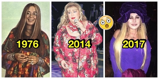 Zerrin Özer'in Kilo Verdiği İçin Gözleri Yerinden Çıkartan İnanılmaz Değişimi Olay Yarattı